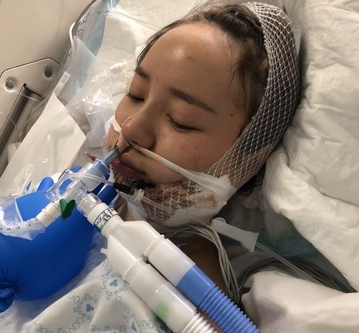 COS纯欲舞娘洛丽塔大哥手上的纹身没了，又变漂亮了！-图集侠